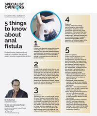 5 Things To Know About Anal Fistula