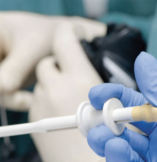 Advanced Endoscopy