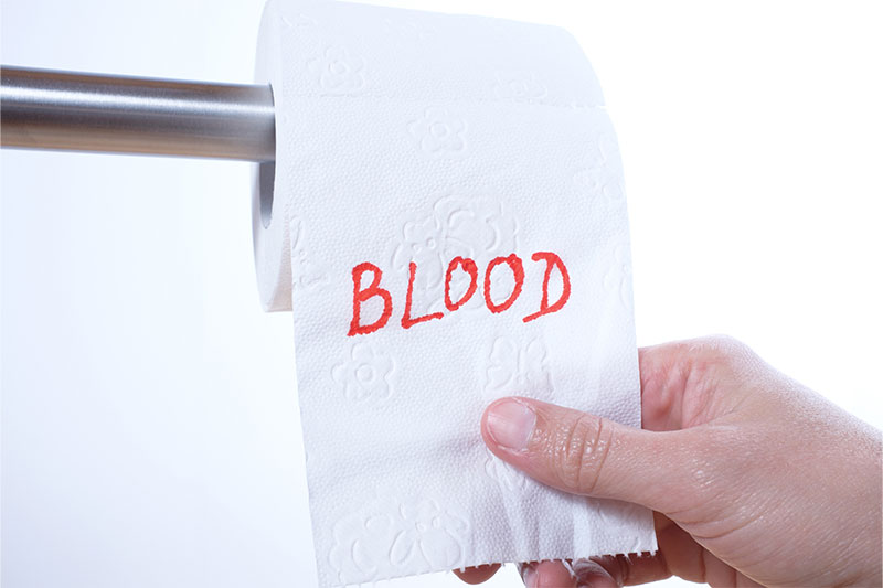 Blood in Stool: When Should You Be Worried?
