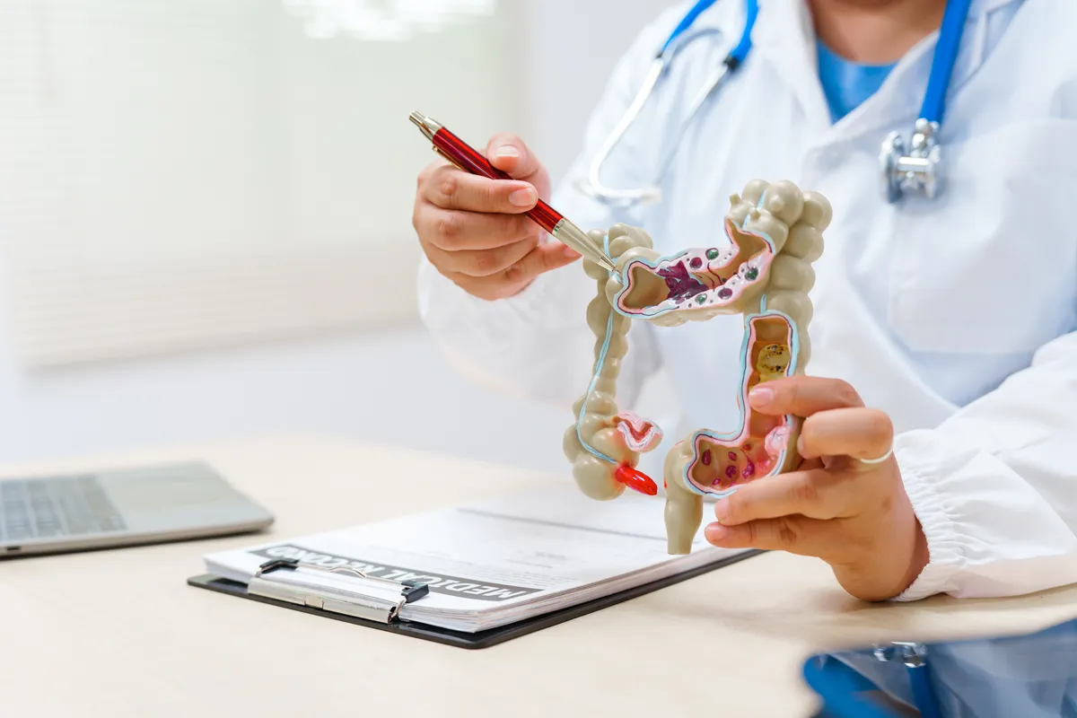 Colon cancer doctor holding a human colon anatomy model during a consultation.