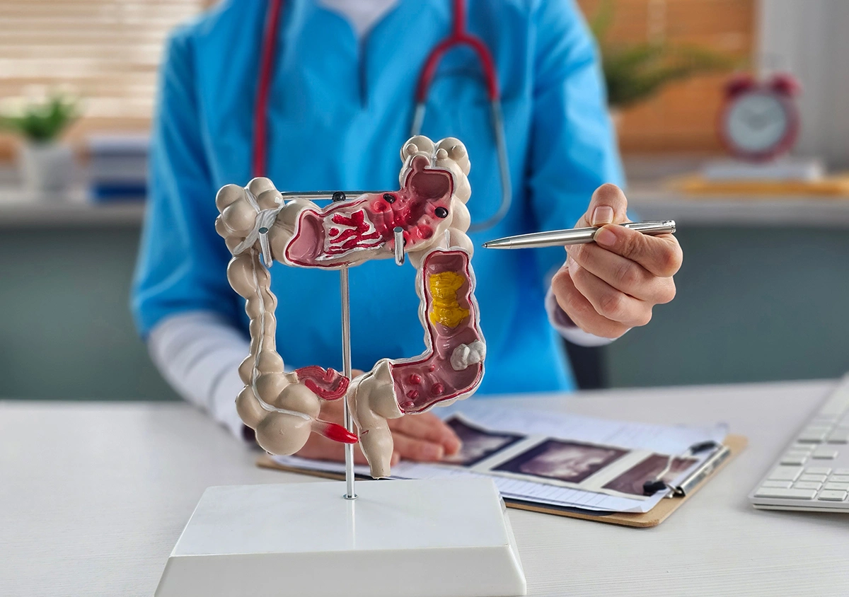 Colorectal surgeon holding a model of the colon while explaining colorectal conditions and post-surgical recovery timeline.