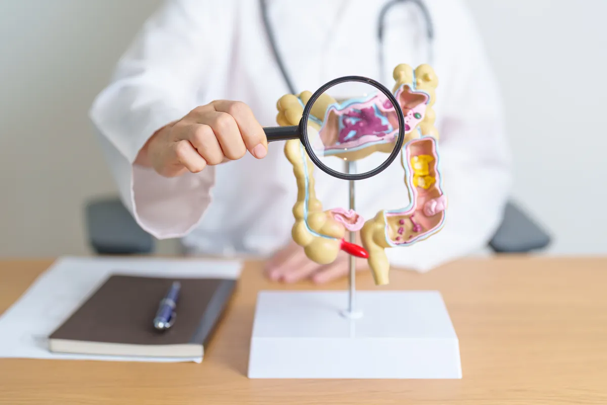 Doctor holding a magnifying glass to a colon model