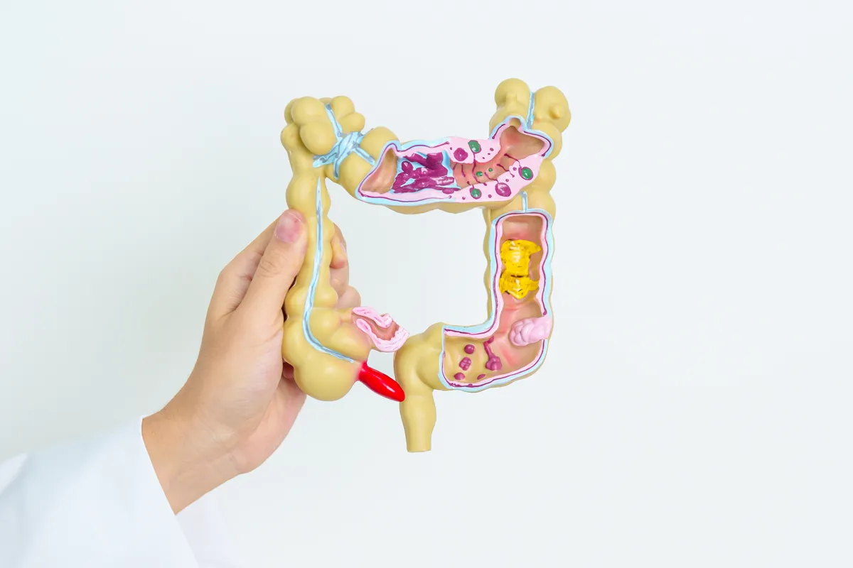 Doctor holding colon model