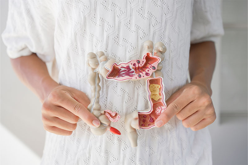 Hands holding a model of the human intestine, illustrating a healthy bowel and digestive system.